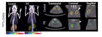 Micro-SPECT shows microplastics cause renal failure in mice