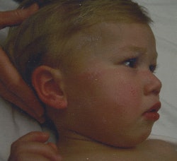 AuntMinnie 2009: California technologist faces testimony in CT overdose case