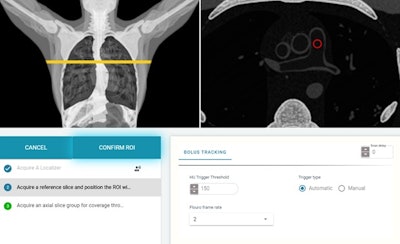 ScanLabMR adds virtual patients to CT simulator