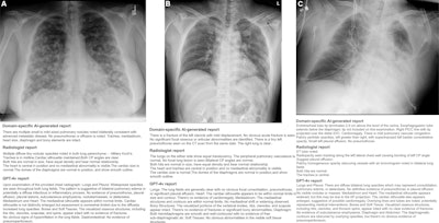 Generative AI model shows promise in chest x-ray study