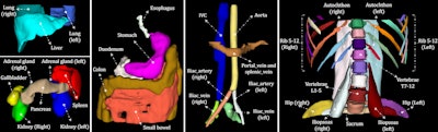 MRI tool segments over 60 abdominal organs, structures