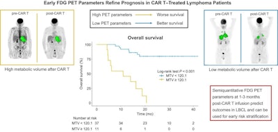 PET scans predict outcomes for patients undergoing CAR T-cell therapy