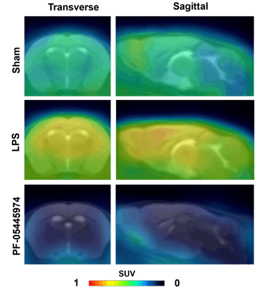 SNMMI: PET tracer images brain inflammation