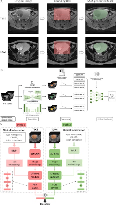 MRI-based DL model improves ovarian lesion classification