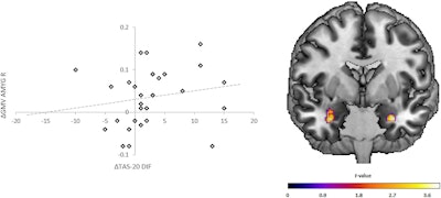 fMRI: Cognitive behavioral therapy positively affects the brain