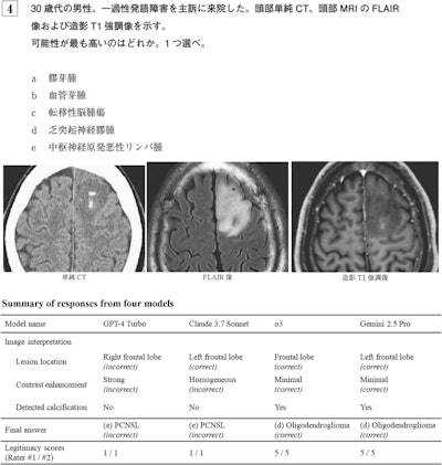 LLMs perform well on Japanese radiology board exam