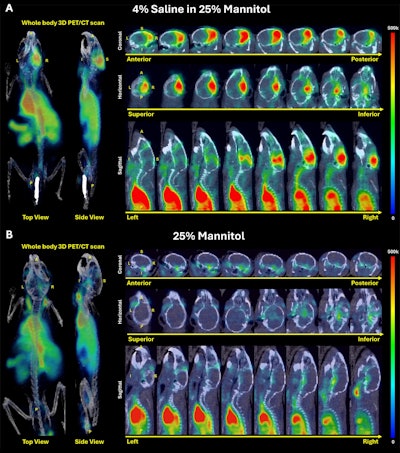 Combination of osmotically active agents improve drug delivery to brain