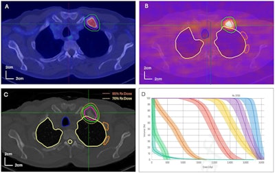 Radiation oncologists put RefleXion’s X1 system to the test