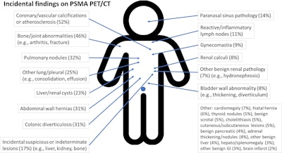 PSMA-PET/CT reporting varies widely in the U.S.