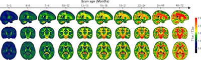 MRI shows myelination patterns across early childhood