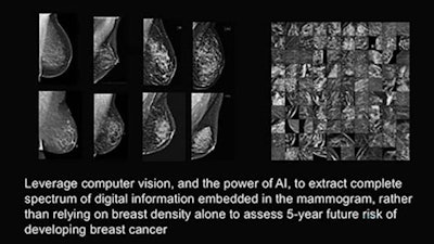 Image-only AI model improves breast cancer risk assessment