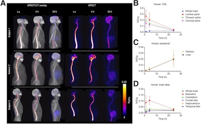 New SPECT/CT tracer visualizes distribution of ALS drug
