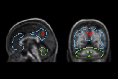 Brain imaging, billing, radiation exposure top 2025’s most-read list