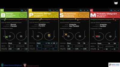 AI ultrasound tool could reduce unnecessary biopsies by 60%