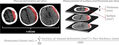 CT, MRI analysis reveal benefits of embolization procedure for hematoma