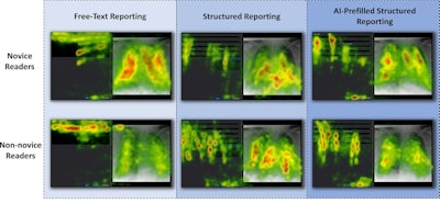 Structured reporting, AI improve chest x-ray workflows