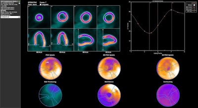 FDG-PET matches MRI in cardiac imaging