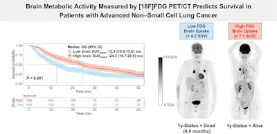PET links brain metabolism to survival in lung cancer patients