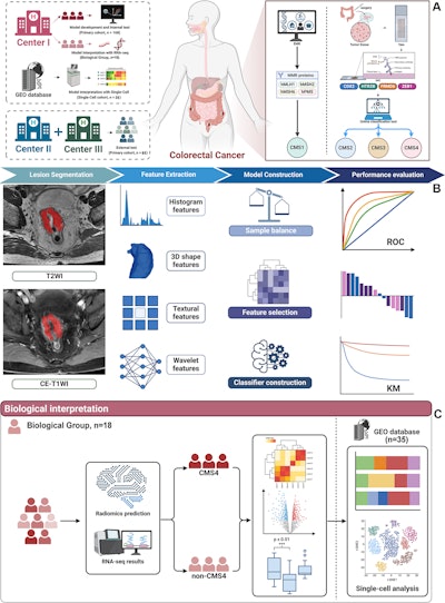 MRI-based ML model shows promise in colorectal cancer subtyping