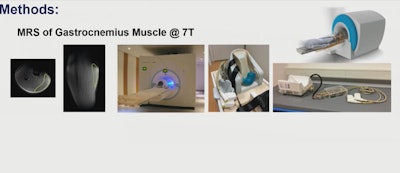 ISMRM: MRI, MRS show metabolic gains from obesity lifestyle intervention