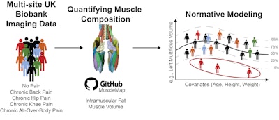 ISMRM: Chronic pain shows region-specific muscle patterns