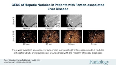 CEUS shows promise in patients with Fontan-associated liver disease