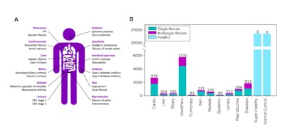 ISMRM: Researchers eye fibrosis patterns in the body’s organs