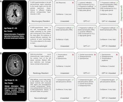 AI diagnostic aid helps novice MRI readers, but experts not so much