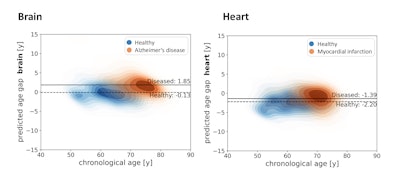ISMRM: MRI-based AI predicts organ aging before disease signs emerge