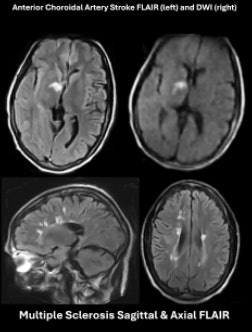 ISMRM: Non-technologists safely operate portable MRI