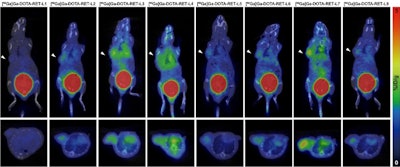 SNMMI: Theranostic approach may treat PSMA-negative prostate cancer