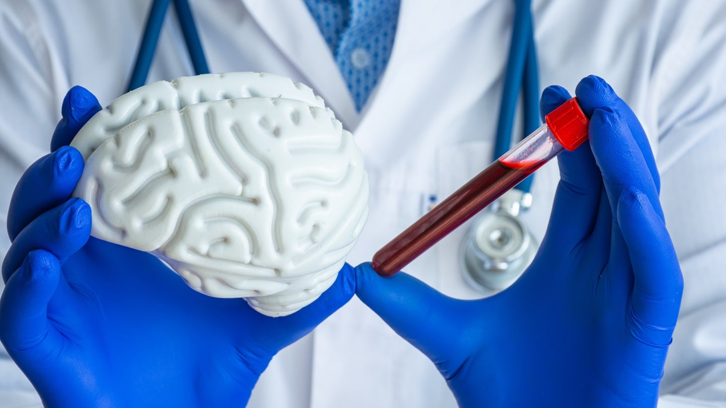 Ionis Pharmaceuticals concludes REVEAL study pivotal cohort enrolment