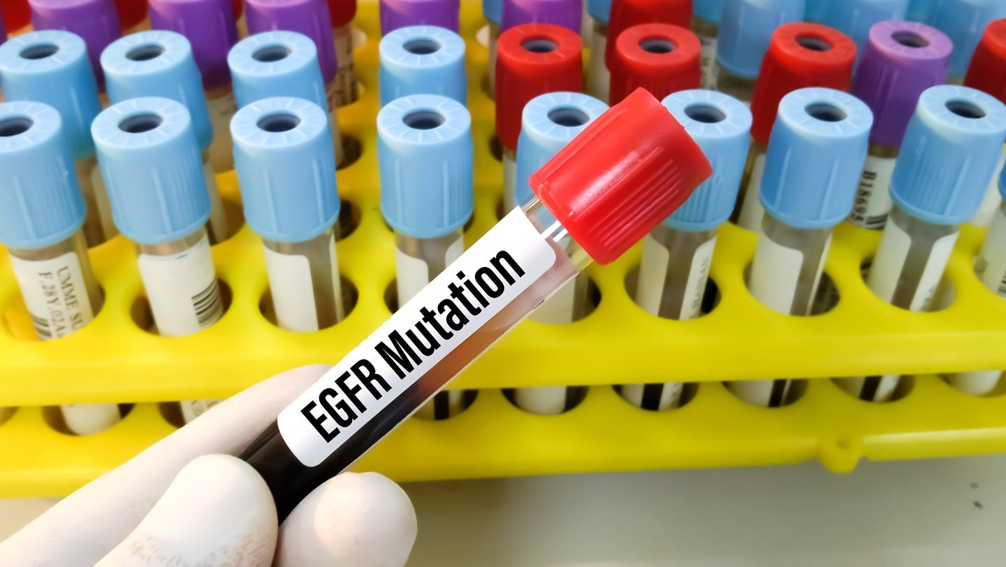Kairos Pharma announces interim Phase I data for ENV-105 in NSCLC