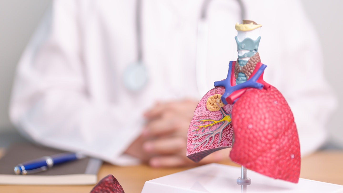 Akagera announces positive Phase I data of AKG-100 in tuberculosis
