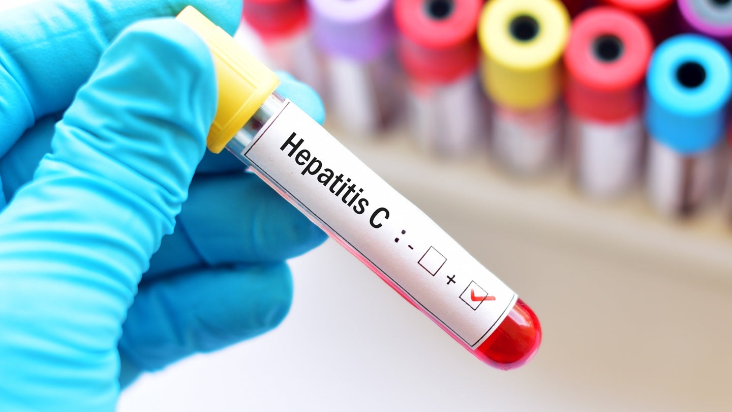 Atea reports positive topline results in Phase III hepatitis C study