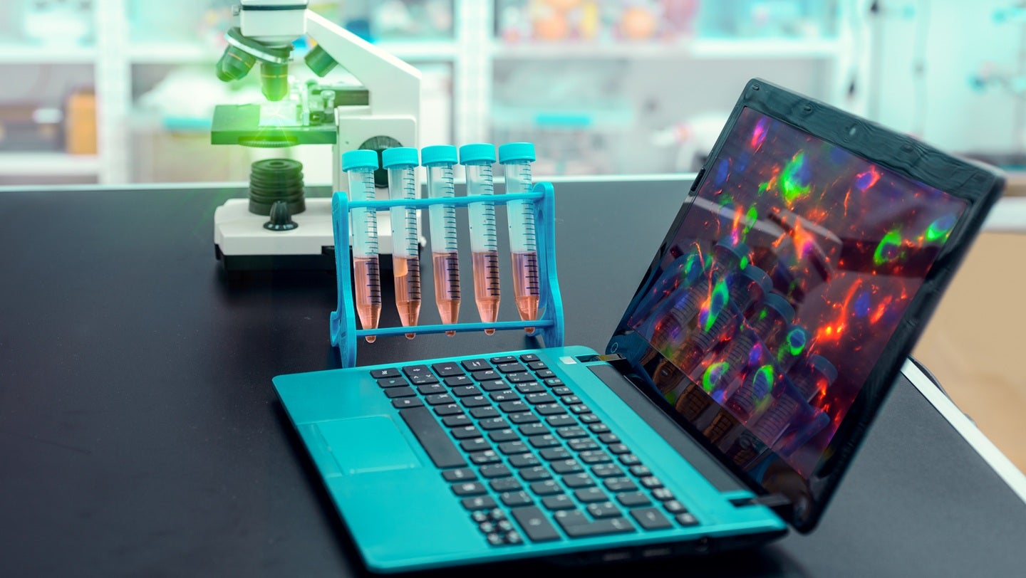 Zydus and Apollo Hospitals sign MoU to launch MCD test in India