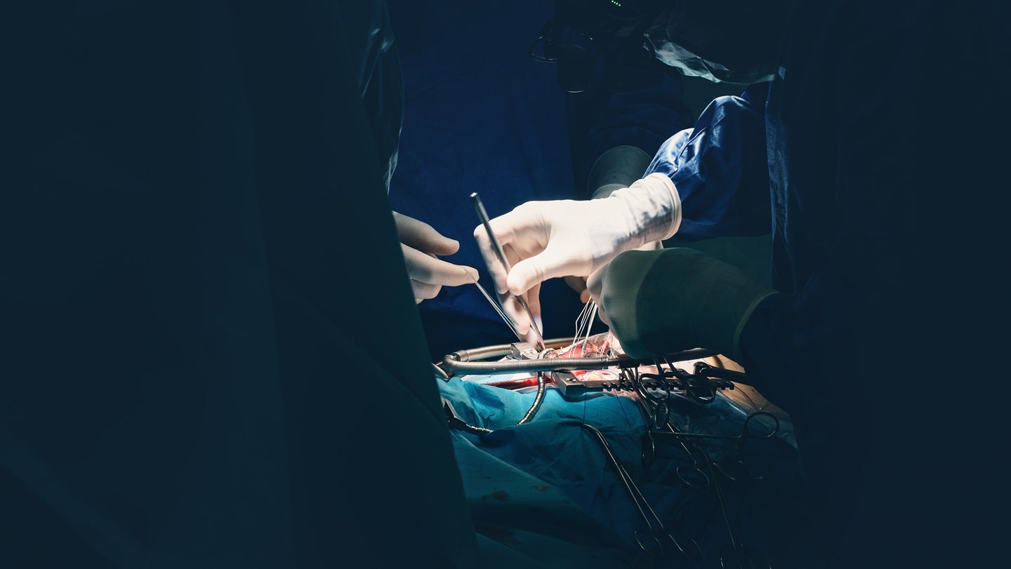 TRiCares begins US IDE pivotal trial of TTVR system
