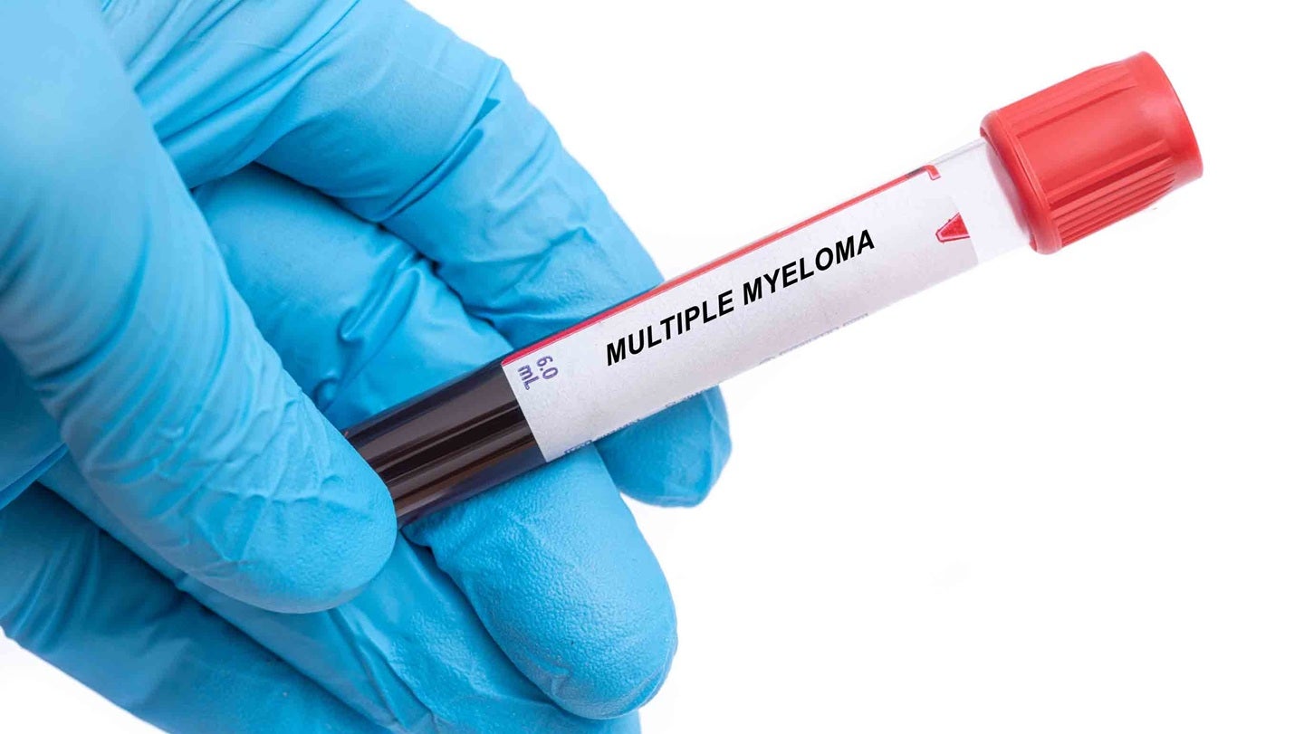 ARUP introduces spectral flow assay for multiple myeloma