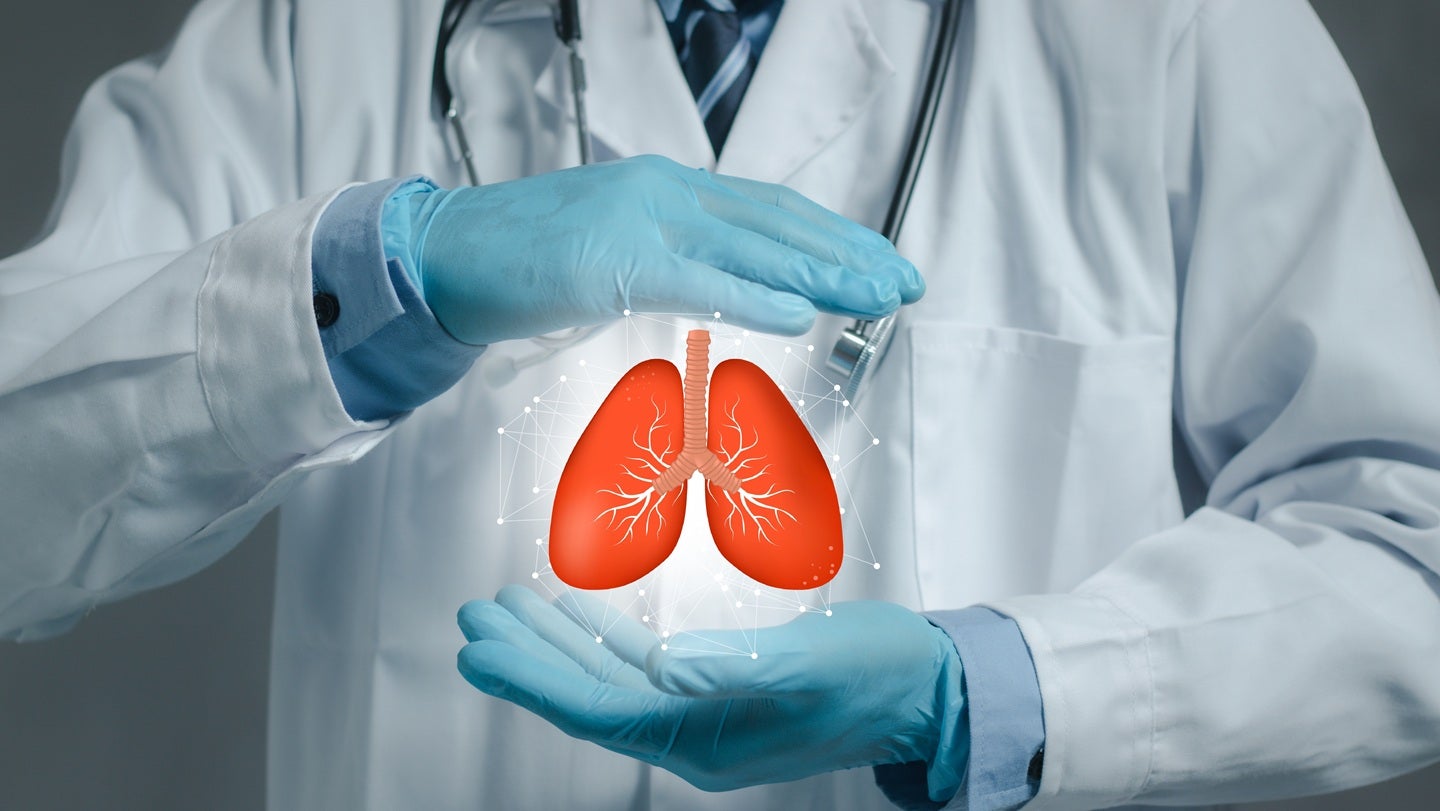Median Technologies and Olea sign partnership for lung cancer device