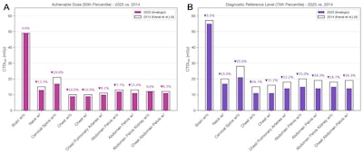 CT radiation doses have fallen sharply over past decade