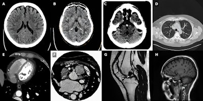 Radiologists can identify three out of four AI-generated images
