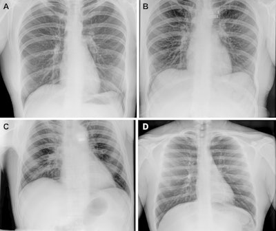 First human x-rays in space deemed diagnostic