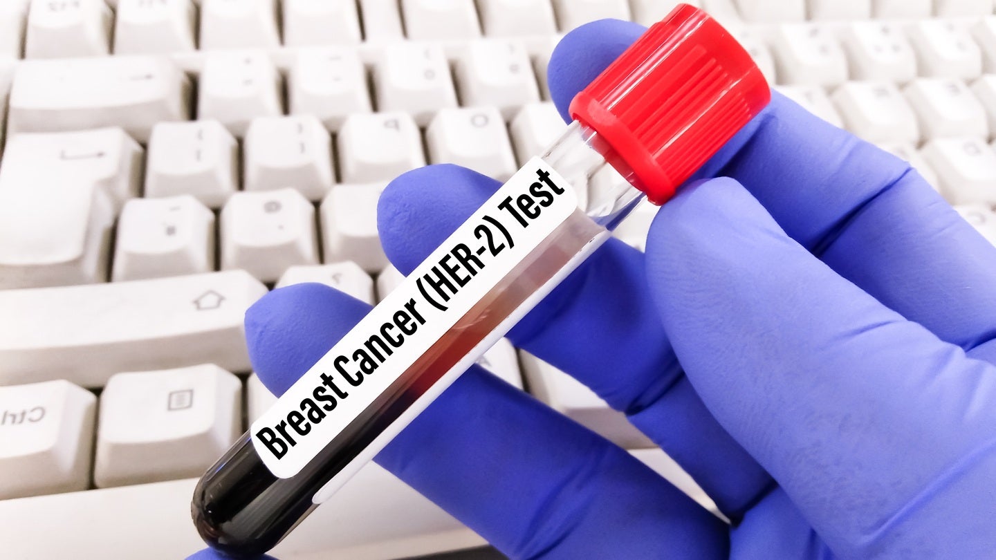 Evexta Bio and Roche plan Phase Ib trial of rupitasertib with giredestrant
