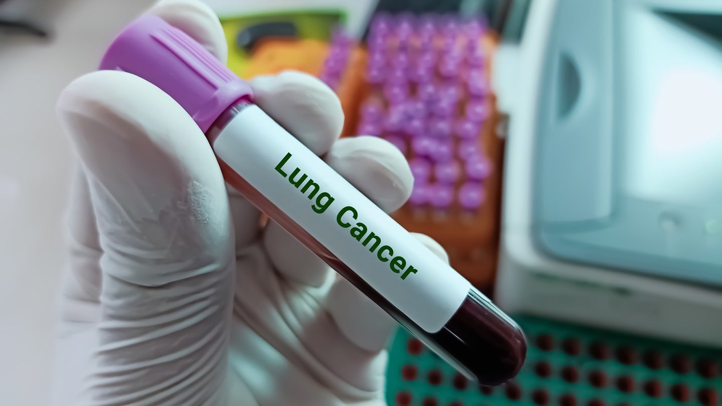 SystImmune doses first patient in Phase III trial for ES-SCLC