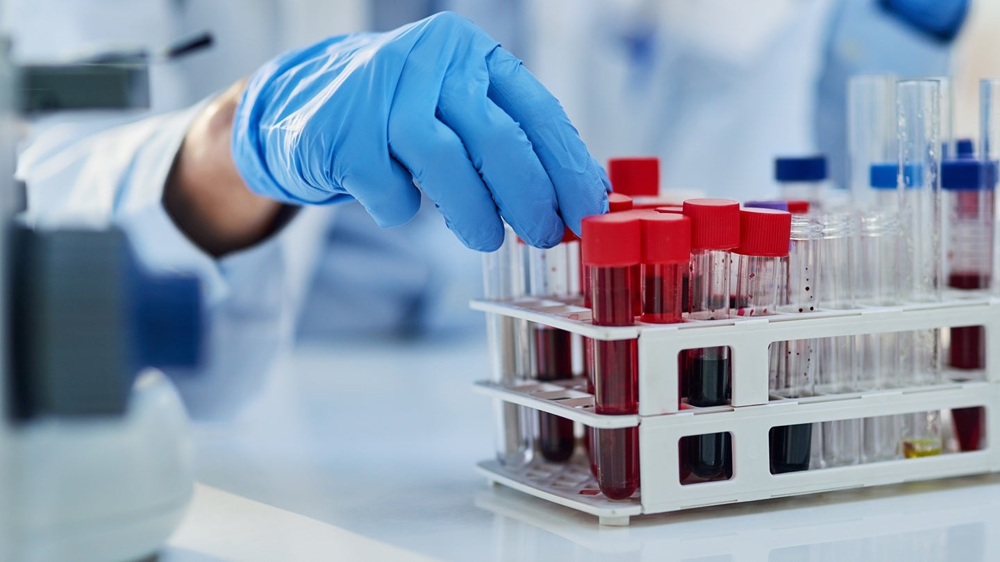 SOPHiA GENETICS partners with AstraZeneca for oncology diagnostics