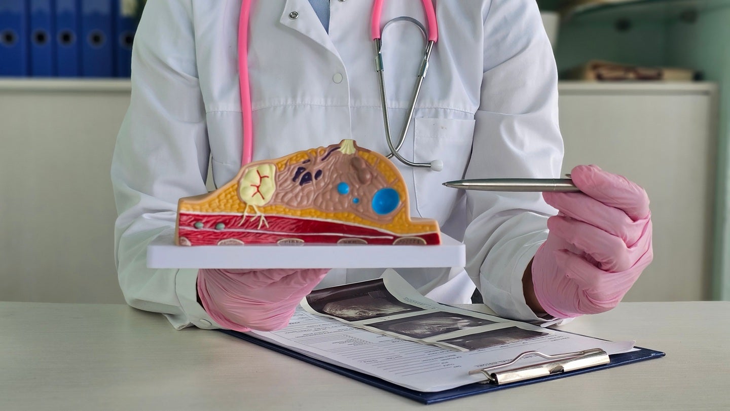 IceCure secures IRB approval for ChoICE Study in US