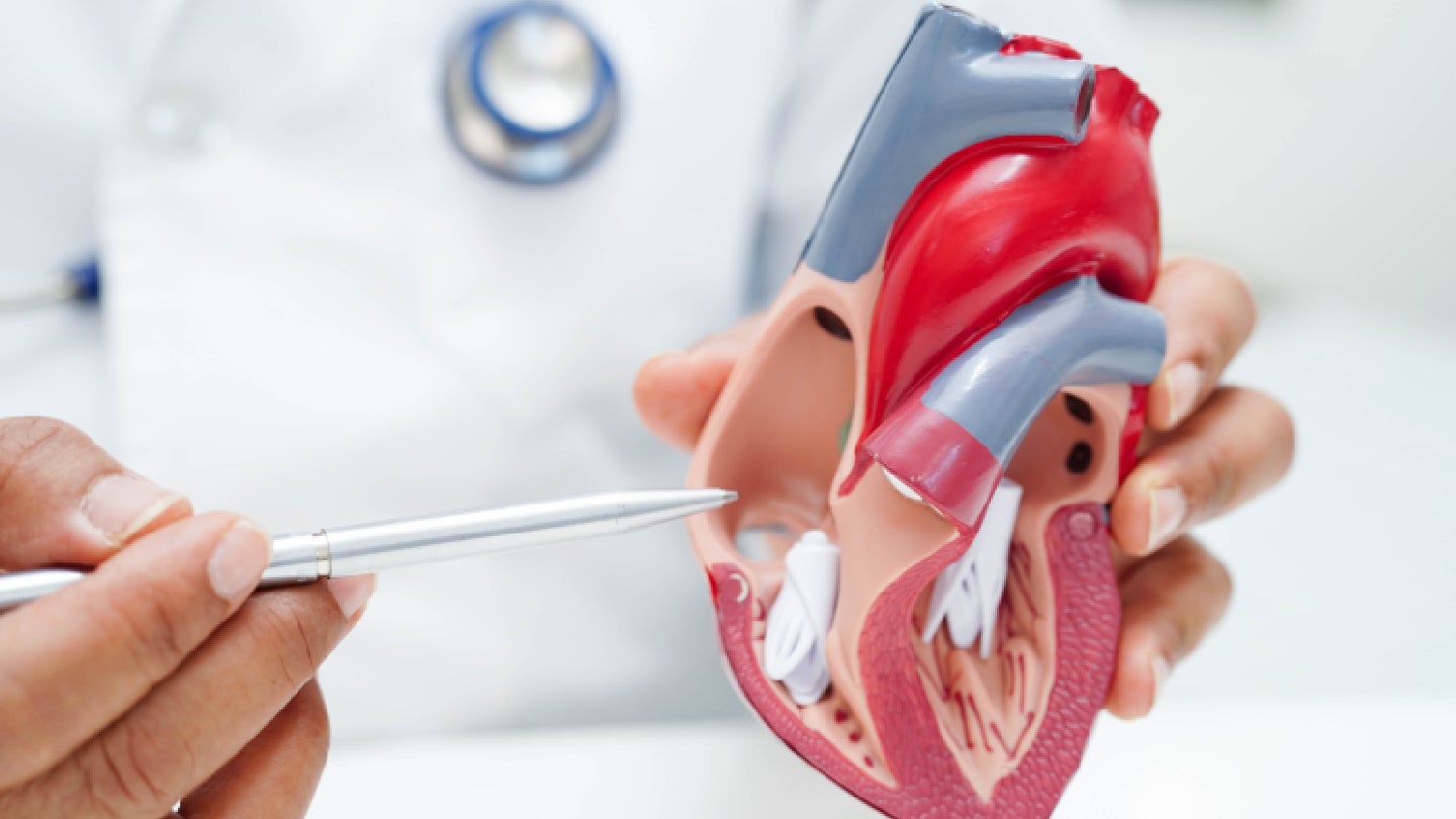 Shape Memory Medical secures $10m to advance aortic clinical trials