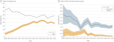 Surveillance imaging doesn’t improve pancreatic cancer survival