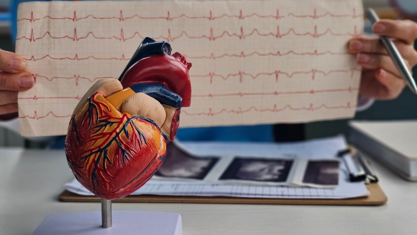 CardiaCare secures seed extension funding for AFib clinical studies