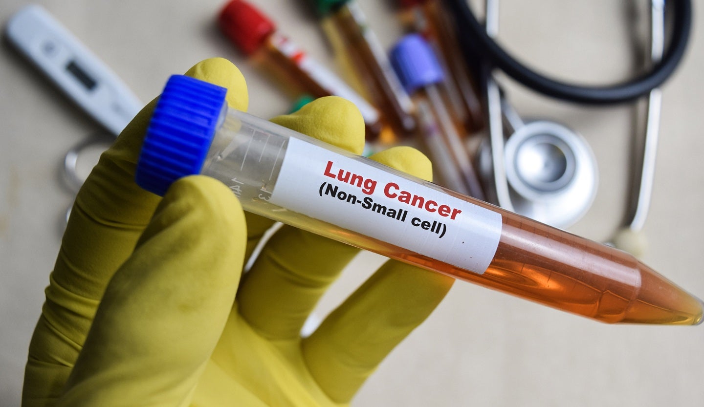 Innovent expands Phase III MarsLight-11 trial to non-squamous NSCLC